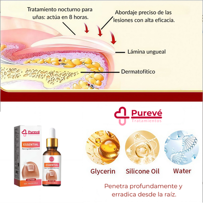 Tratamiento Profesional Anti Hongos