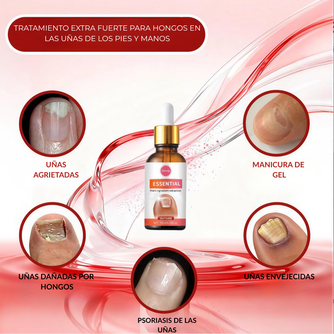 Tratamiento Profesional Anti Hongos