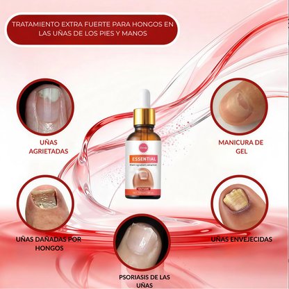 Tratamiento Profesional Anti Hongos