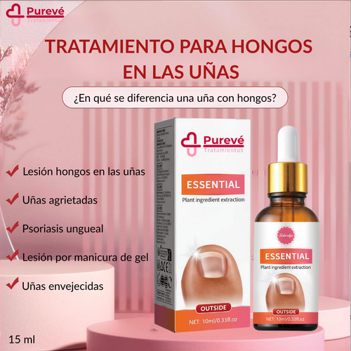 Tratamiento Profesional Anti Hongos