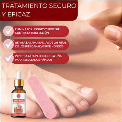 Tratamiento Profesional Anti Hongos